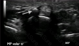 RhMSUS Question 29